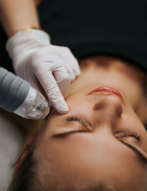 allogeneic fat transfer