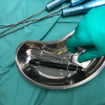 AlloClae vs Autologous Fat (2)