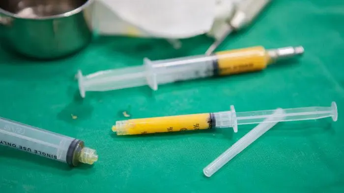 AlloClae vs Autologous Fat